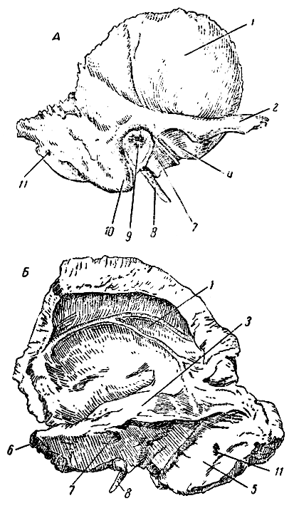 Рис. 37. Височная кость (правая). А - вид снаружи; Б - вид изнутри; 1 - чешуя; 2 - скуловой отросток; 3 - передняя поверхность каменистой части 4 - суставная ямка; 5 - сигмовидная борозда; 6 - верхушка пирамидки; 7 - на верхнем рисунке - барабанная часть; на нижнем рисунке - внутреннее слуховое отверстие; 8 - шиловидный отросток; 9 - наружное слуховое отверстие; 10 - сосцевидный отросток; 11 - сосцевидное отверстие