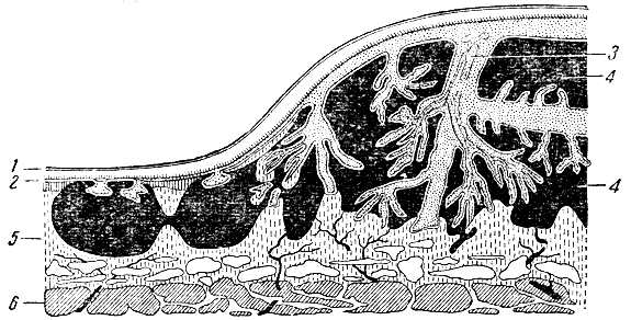 Рис. 91. Схема строения плаценты человека (в разрезе). 1 - амнион; 2 - хорион; 3 - ворсины хориона; 4 - лакуны; 5 - слизистая оболочка матки (базальная пластинка); 6 - мышечная оболочка матки