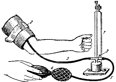 Рис. 116. Сфигмоманометр для измерения кровяного давления у человека. 1 - ртутный манометр; 2 - манжетка; 3 - клапан; 4 - резиновая груша; 5 - резиновые трубки, соединяющие манометр с манжеткой и грушей