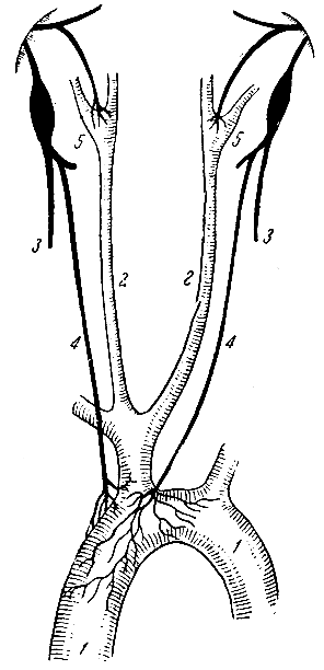 Рис. 118. Схема депрессорного нерва. 1 - дуга аорты; 2 - общие сонные артерии; 3 - блуждающие нервы; 4 - депрессорные нервы; 5 - внутренняя сонная артерия