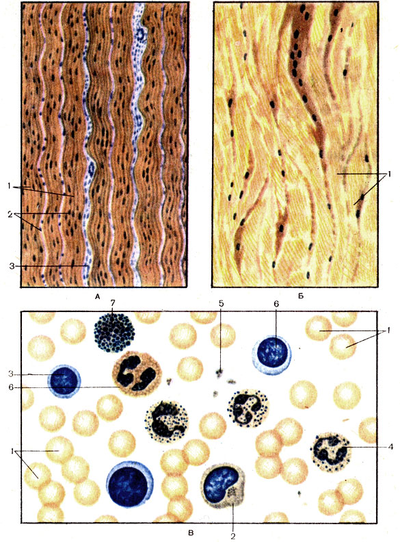Рис. 3. Плотная оформленная волокнистая соединительная ткань (A, Б) и кровь (В). А - сухожилие (tendo): 1 - коллагеновые волокна (fibrae collagenosae); 2 - тендиноцит, или сухожильная клетка (tendinocytus); 3 - прослойки рыхлой волокнистой соединительной ткани. Б - связка (iigamentum): 1 - эластические волокна (fibrae elasticae). В - кровь (sanguis): 1 - эритроцит (erytrocytus); 2 - моноцит (monocytus); 3 - лимфоцит (lymphocytic); 4 - сегментоядерный нейтрофильный гранулоцит (granulocytus neutrophilicus segmentonuclearis); 5 - тромбоциты, или кровяные пластинки (thrombocyti); 6 - ацидофильный (эозинофильный) гранулоцит [granulocytus acidophilicum (eosinophilicus)]; 7 - базофильный гранулоцит (qranulocytus basophi licus)