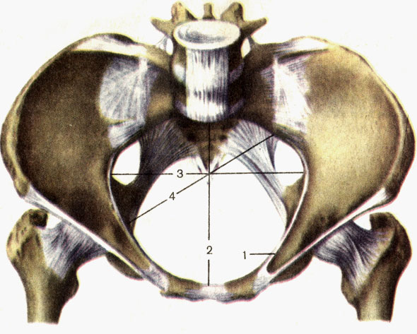 Рис. 37. Женский таз; вид сверху. 1 - пограничная линия (tinea terminalis); 2 - анатомическая конъюгата, или прямой диаметр (diameter recta), малого таза; 3 - поперечный диаметр (diameter transversa) малого таза; 4 - косой диаметр (diameter obliqua) малого таза