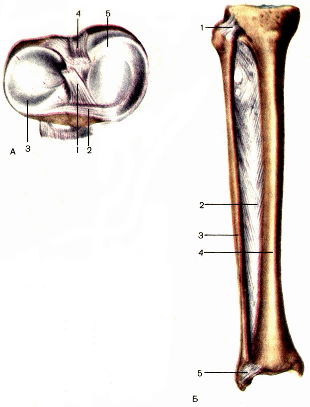 Рис. 44. Мениски коленного сустава (А). Соединения костей голени (Б). А: 1 - передняя крестообразная связка (lig. cruciatum anterius); 2 - поперечная связка колена (lig. transversum genus); 3 - латеральный мениск (meniscus lateralis); 4 - задняя крестообразная связка (lig. cruciatum posterius); 5 - медиальный мениск (meniscus medialis). Б: 1 - межберцовый сустав (articulatio tibiofibularis); 2 - межкостная перепонка голени (membrane interossea cruris); 3 - малоберцовая кость (fibula); 4 - большеберцовая кость (tibia); 5 - межберцовый синдесмоз (syndesmosis tibiofibularis)
