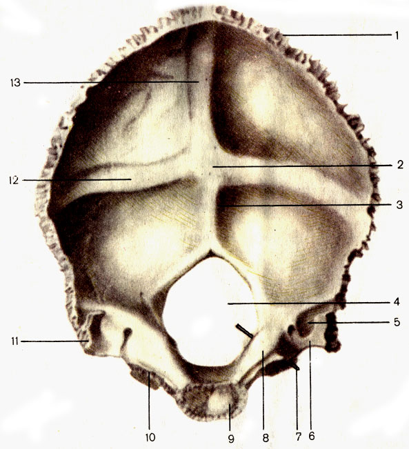 Рис. 47. Затылочная кость; вид изнутри. 1 - затылочная чешуя (squama occipitalis); 2 - внутренний затылочный выступ (protuberantia occipitalis interna); 3 - внутренний затылочный гребень (crista occipitalis interna); 4 - большое затылочное отверстие (foramen magnum); 5 - борозда сигмовидного синуса (sulcus sinus sigmoideus); 6 - яремная вырезка (incisure jugularis); 7 - зонд введен в подъязычный канал (canalis hypoglossi); 8 - яремный бугорок (tuberculum jugulare); 9 - базилярная часть (pars basilaris); 10 - латеральная часть (pars lateralis); 11 - яремный отросток (processus jutjularis); 12 - борозда поперечного синуса (sulcus sinus transversi); 13 - борозда верхнего сагиттального синуса (sulcus sinus sagittalis superioris)