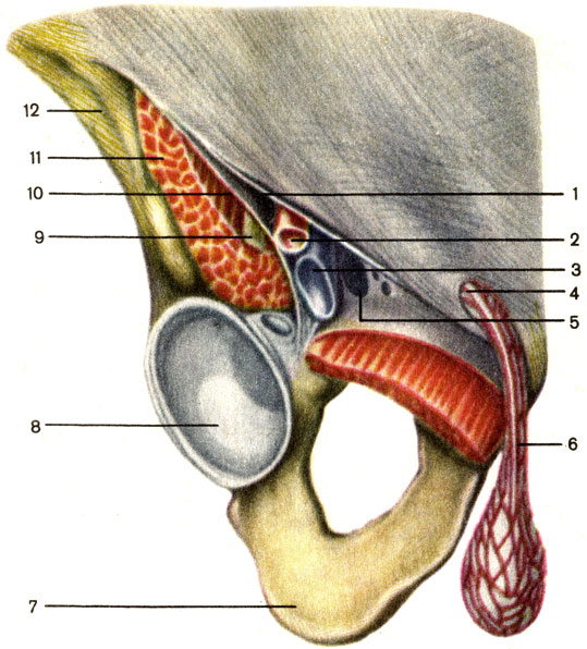 Рис. 70. Паховая область, правая; вид спереди. 1 - паховая связка (lig. inguinale); 2 - бедренная артерия; 3 - бедренная вена; 4 - поверхностное паховое кольцо (annulus inguinalis superficialis); 5 - бедренное кольцо (annulus femoralis); 6 - семенной канатик (funiculus spermaticus); 7 - седалищная кость; 8 - вертлужная впадина; 9 - бедренный нерв; 10 - подвздошно-гребенчатая дуга (arcus iliopectineus); 11 - подвздошно-поясничная мышца (m. iliopsoas); 12 - подвздошная кость