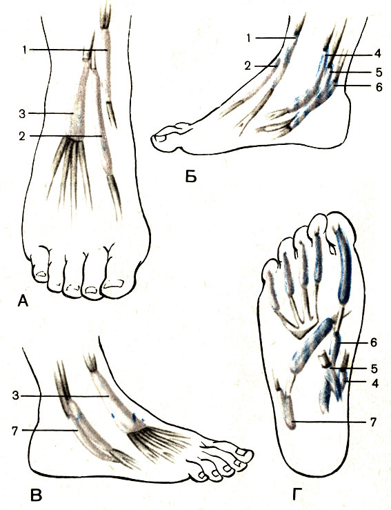 Рис. 88. Синовиальные влагалища стопы, правой. А - тыльная поверхность; Б - медиальная сторона; В - латеральная сторона; Г - подошвенная поверхность; 1 - влагалище сухожилия передней большеберцовой мышцы (vagina tendinis m. tibialis anterioris); 2 - влагалище сухожилия длинного разгибателя большого пальца стопы (vagina tendinis m. extensoris hallucis longi); 3 - влагалище сухожилий длинного разгибателя пальцев стопы (vagina tendinum m. extensoris digitorum pedis longi); 4 - влагалище сухожилия задней большеберцовой мышцы (vagina tendinis m. tibialis posterioris); 5 - влагалище сухожилий длинного сгибателя пальцев стопы (vagina tendinum m. flexoris digitorum pedis longi); 6 - синовиальное влагалище сухожилия длинного сгибателя большого пальца стопы (vagina tendinis m. flexoris hallucis longi); 7 - общее влагалище малоберцовых мышц (vagina mm. peroneorum communis)