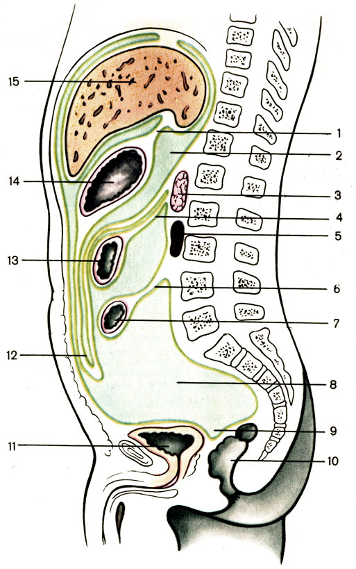 Рис. 100. Взаимоотношение брюшины с органами и стенками брюшной полости. 1 - малый сальник (omentum minus); 2 - сальниковая сумка (bursa omentalis); 3 - поджелудочная железа (pancreas); 4 - брыжейка поперечной ободочной кишки (mesocolon transversum); 5 - почка (ren); 6 - брыжейка тонкой кишки (mesenterium); 7 - тонкая кишка (intestinum tenue); 8 - полость брюшины (cavitas peritonei); 9 - прямокишечно-пузырное углубление (excavatio rectovesicalis); 10 - прямая кишка (rectum); 11 - мочевой пузырь (vesica urinaria); 12 - большой сальник (omentum majus); 13 - поперечная ободочная кишка (colon transversum); 14 - желудок (gaster); 15 - печень (hepar)