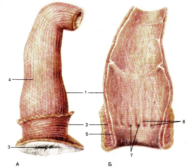 Рис. 111. Прямая кишка. А - вид снаружи; Б - вид изнутри; 1 - ампула прямой кишки (ampulla recti); 2 - наружный сфинктер заднего прохода (m. sphincter ani externus); 3 - задний проход (anus); 4 - продольный слой (stratum longitudinale) мышечной оболочки; 5 - внутренний сфинктер заднего прохода (m. sphincter ani internus); 6 - заднепроходные (анальные) столбы (columnae anaies); 7 - заднепроходные (анальные) пазухи (sinus anales)