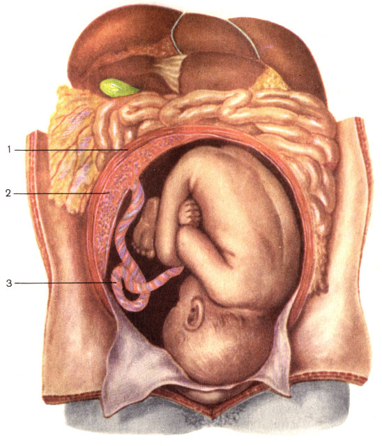 Рис. 131. Матка с плодом (вскрыта). 1 - стенка матки; 2 - плацента (placenta); 3 - пупочный канатик (funiculus umbilicalis)