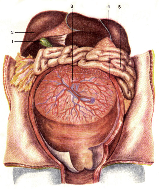 Рис. 132. Матка с плацентой (вскрыта, плод извлечен). 1 - желчный пузырь (vesica biliaris); 2 - печень (hepar); 3 - плацента (placenta); 4 - стенка матки; 5 - тонкая кишка (intestinum tenue)
