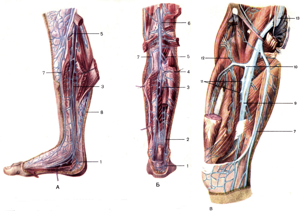 Рис. 162. Глубокие вены нижней конечности, правой. А - вены голени, медиальная поверхность; Б - вены задней поверхности голени; В - вены бедра, переднемедиальная поверхность; 1 - венозная сеть пяточной области; 2 - венозная сеть в области лодыжек; 3 - задние большеберцовые вены (vv. tibiales posteriores); 4 - малоберцовые вены (vv. fibulares); 5 - передние большеберцовые вены (vv. tibiales anteriores); 6 - подколенная вена (v. poplitea); 7 - большая подкожная вена ноги (v. saphena magna); 8 - малая подкожная вена ноги (v. saphena parva); 9 - бедренная вена (v. femoralis); 10 - глубокая вена бедра (v. profunda femoris); 11 - прободающие вены (vv. perforates); 12 - латеральные вены, огибающие бедренную кость (vv. circumflexae laterales femoris); 13 - наружная подвздошная вена (v. iliаса externa)