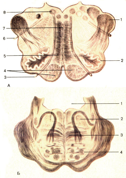 Рис. 181. Поперечный разрез продолговатого мозга (А) и моста (Б). А: 1 - нижняя мозжечковая ножка (pedunculus cerebellaris caudalis); 2 - нижнее оливное ядро (nucleus olivaris caudalis); 3 - подъязычный нерв (n. hypoglossus); 4 - пирамиды продолговатого мозга (pyramides); 5 - медиальная петля (lemniscus medialis); 6 - блуждающий нерв (n. vagus); 7 - шов продолговатого мозга (raphe medullae oblongatae); 8 - ядро подъязычного нерва (nucleus nervi hypoglossi). Б: 1 - полость IV желудочка; 2 - покрышка моста (tegmentum pontis); 3 - трапециевидное тело (corpus trapezoideum); 4 - корково-спинномозговые волокна (fibrae corticospinales)